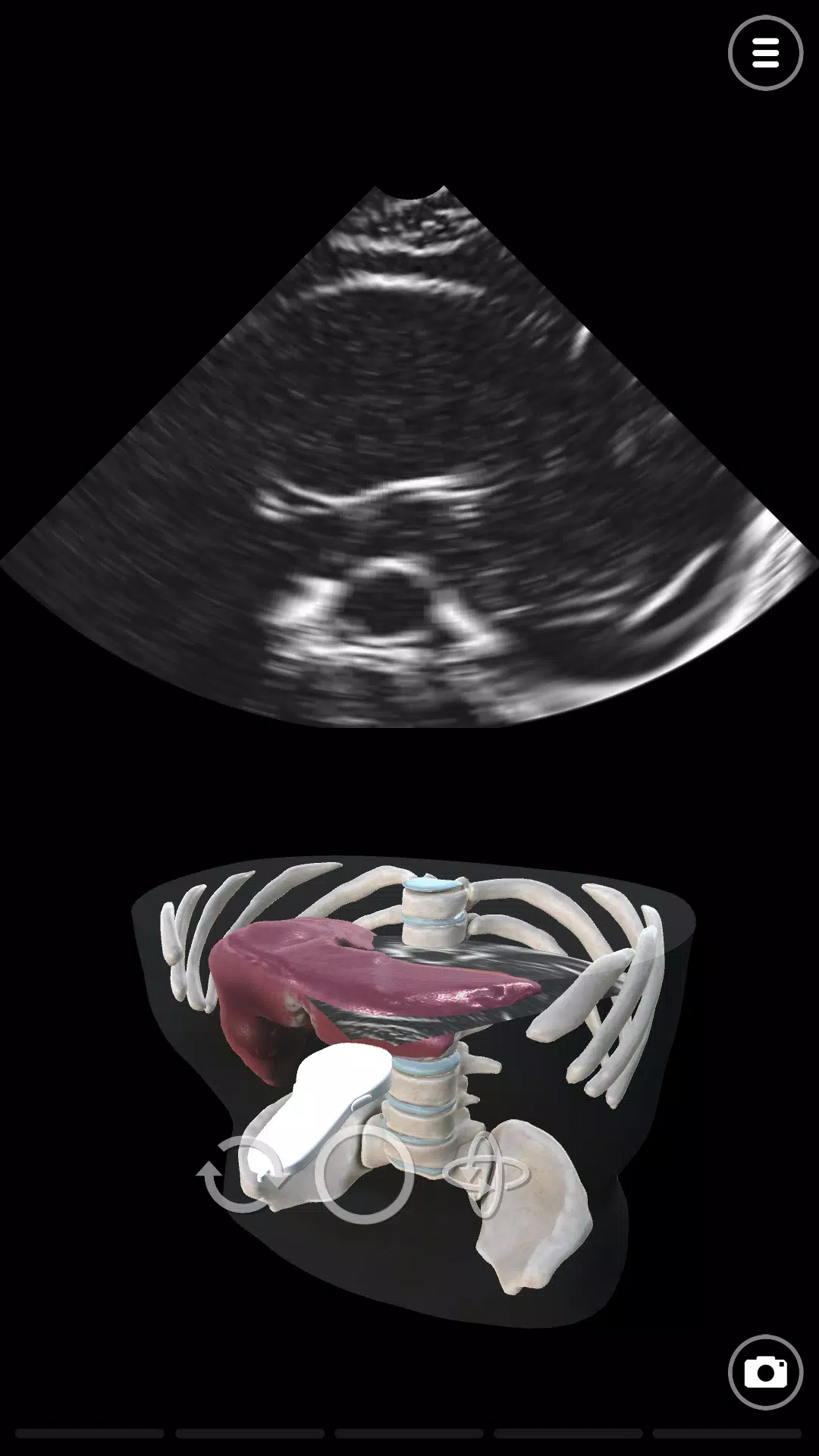 Deepscope Ultrasound Simulator應用截圖第2張