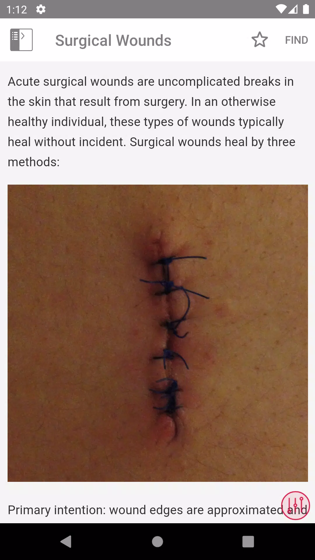 Wound Care MI Visual ဖန်သားပြင်ဓာတ်ပုံ 4