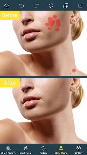 Photo Retouch- Object Removal ဖန်သားပြင်ဓာတ်ပုံ 2