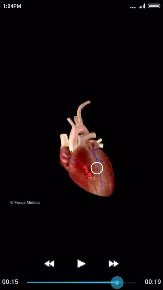 Cardiology-Animated Dictionary Screenshot 3