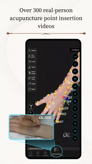Schermata Acupuncture Master 4