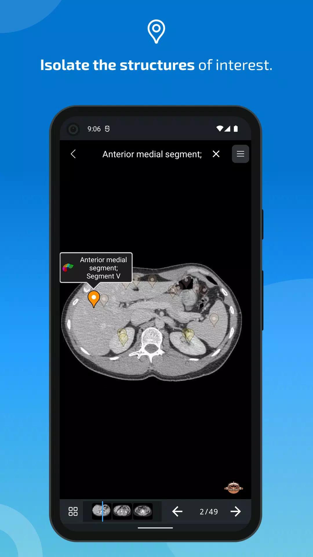 e-Anatomy Ekran Görüntüsü 4