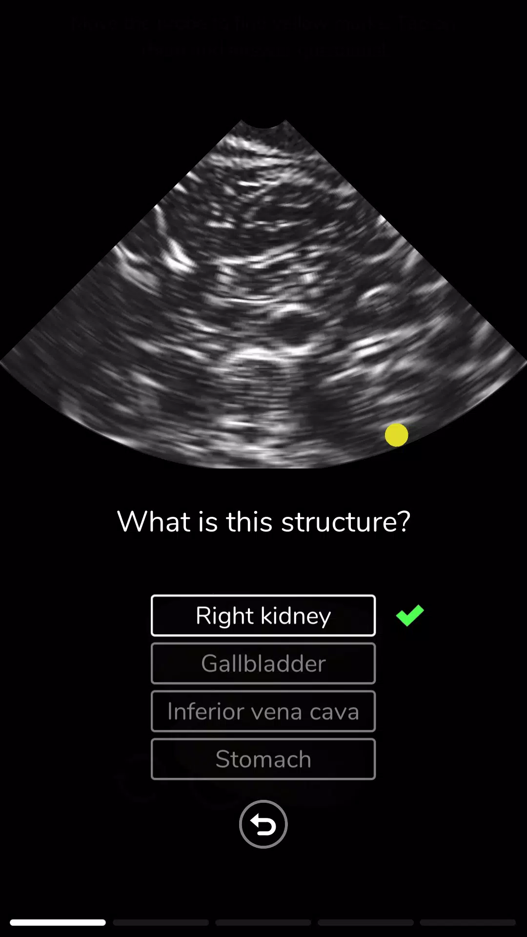 Deepscope Ultrasound Simulator應用截圖第4張